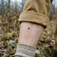 Customer photo — tick spotted crawling on a leg, not attached